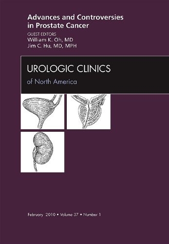 Book The Urologic Clinics of North America (Benign Prostatic Hyperplasia, Vol. 17) free