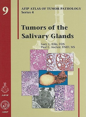 Book Tumors Of The Salivary Glands (afip Atlas Of Tumor Pathology: Series 4) free