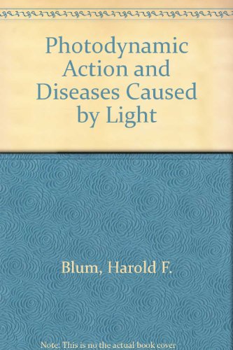 Book Photodynamic Action And Diseases Caused By Light free