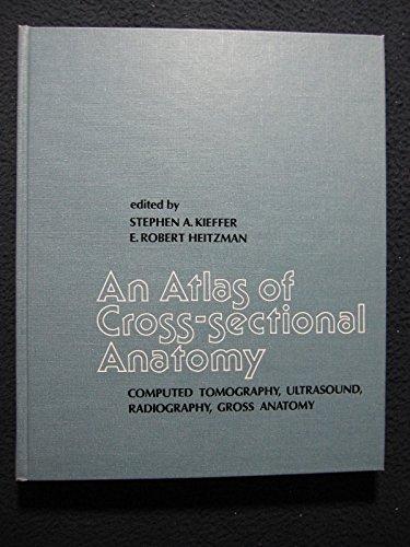 Book An Atlas Of Cross-sectional Anatomy: Computed Tomography, Ultrasound, Radiography, Gross Anatomy free