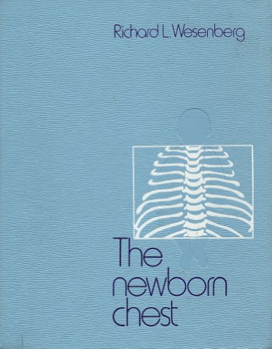 Book The newborn chest free