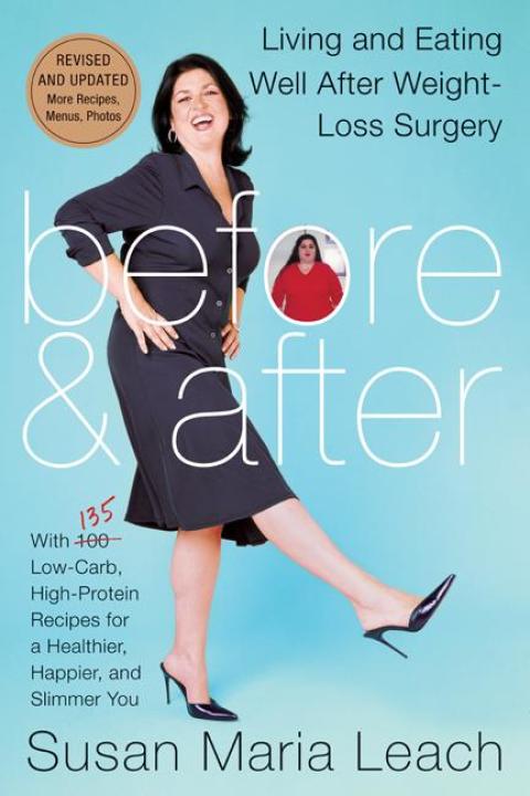 Book Before & After, Revised Edition: Living and Eating Well After Weight-Loss Surgery free