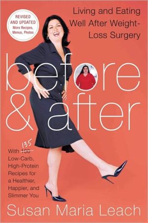 Book Before & After, Second Revised Edition: Living and Eating Well After Weight-Loss Surgery free