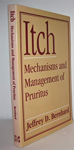 Book Itch: Mechanisms and Management of Pruritus free