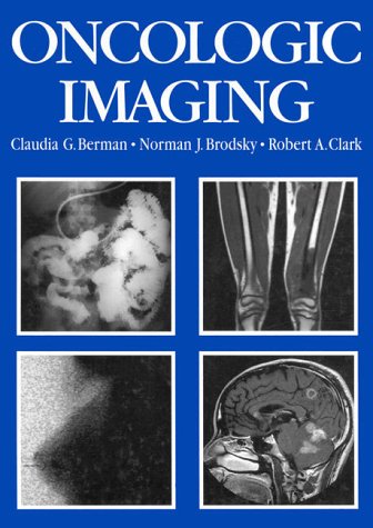 Book Oncologic Imaging: A Clinical Perspective free