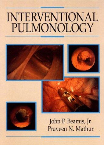 Book Interventional Pulmonology free