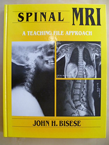 Book Spinal Mri: A Teaching File Approach free