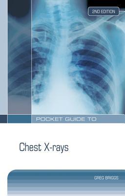 Book Pocket Guide to Chest X-rays free