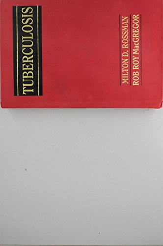 Book Tuberculosis: Clinical Management and New Challenges free