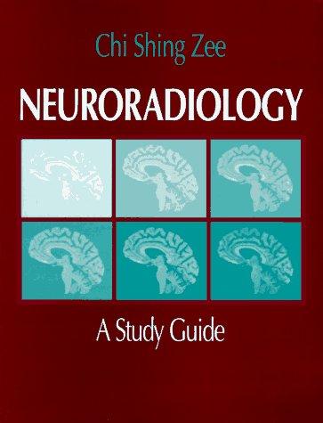 Book Neuroradiology: A Study Guide free