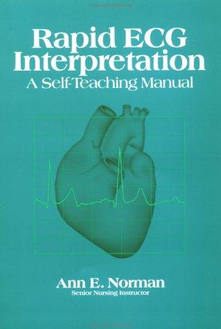 Book Rapid Ecg Interpretation free