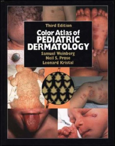 Book Color Atlas Of Pediatric Dermatology free