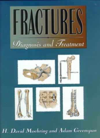 Book Fractures: Diagnosis and Treatment free