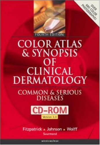 Book Color Atlas and Synopsis of Clinical Dermatology, Book & CD-ROM free