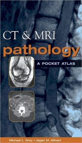 Book CT & MRI Pathology: A Pocket Atlas free
