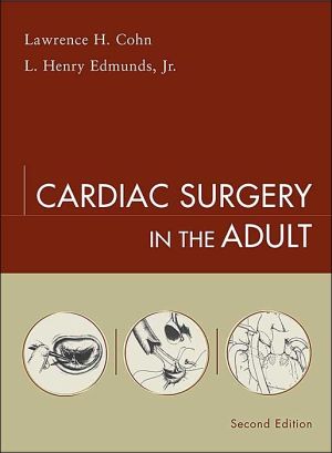 Book Cardiac Surgery in the Adult free