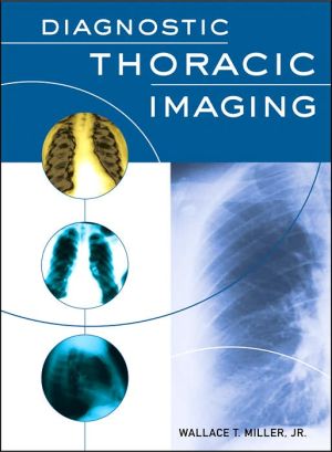 Book Diagnostic Thoracic Imaging free