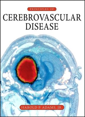 Book Principles of Cerebrovascular Disease free