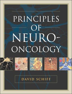 Book Principles and Practice of Neuro-Oncology free