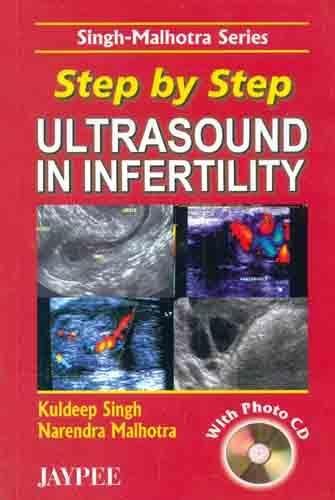 Book Step by Step Ultrasound in Infertility free