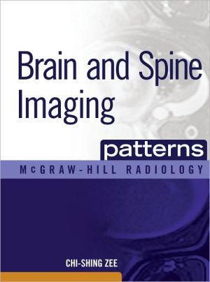 Book Brain and Spine Imaging Patterns (McGraw-Hill Radiology) free