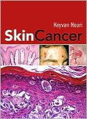 Book Skin Cancer free
