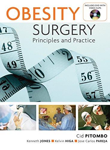 Book Obesity Surgery: Principles and Practice [With DVD] free