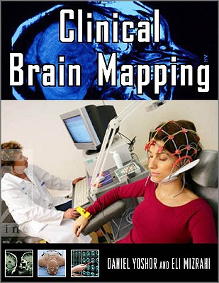 Book Clinical Brain Mapping free