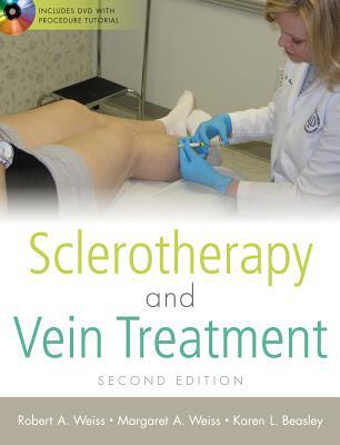 Book Sclerotherapy and Vein Treatment, Second Edition SET free