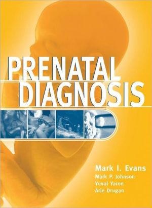 Book Prenatal Diagnosis free