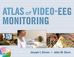 Book Atlas of Video-EEG Monitoring free