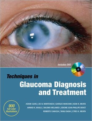 Book Techniques in Glaucoma Diagnosis and Treatment free