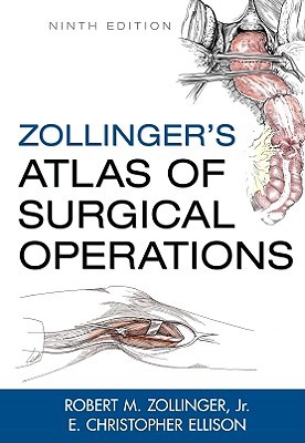 Book Zollinger's Atlas of Surgical Operations, 9th Edition free