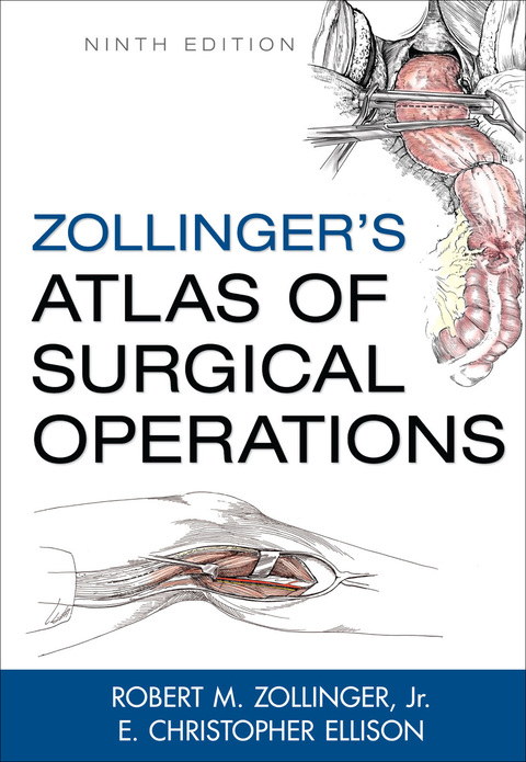 Book Zollinger's Atlas of Surgical Operations, Ninth Edition free