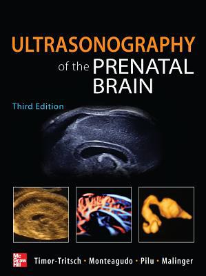 Book Ultrasonography of the Prenatal Brain, Third Edition free
