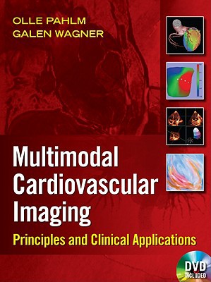 Book Multimodal Cardiovascular Imaging: Principles and Clinical Applications free