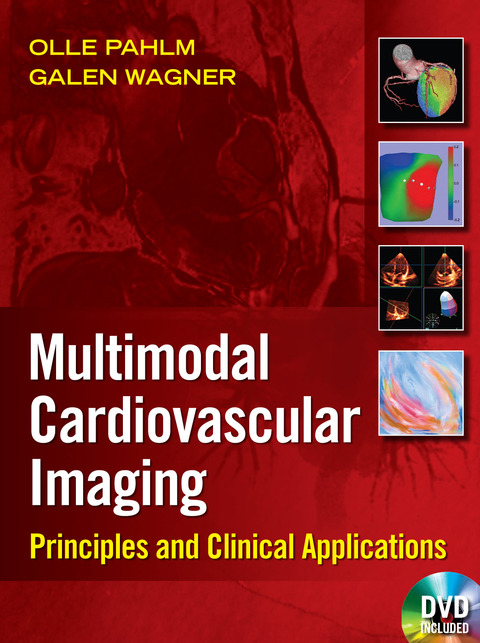 Book Multimodal Cardiovascular Imaging: Principles and Clinical Applications free