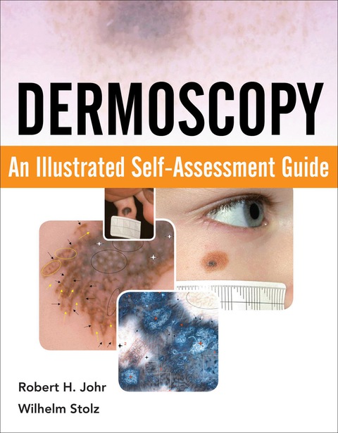 Book Dermoscopy: An Illustrated Self-Assessment Guide free