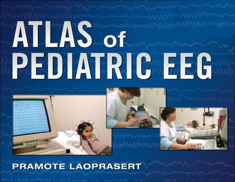 Book Atlas of Pediatric EEG free