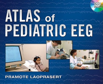 Book Atlas of Pediatric EEG (Atlas Series) free