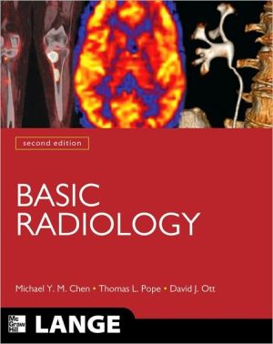 Book Basic Radiology, Second Edition (LANGE Clinical Medicine) free