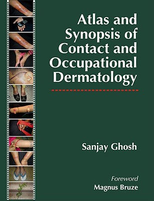Book Atlas and Synopsis of Contact and Occupational Dermatology free