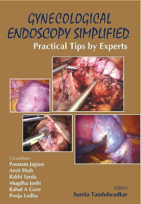 Book Gynecological Endoscopy Simplified: Practical Tips by Experts free