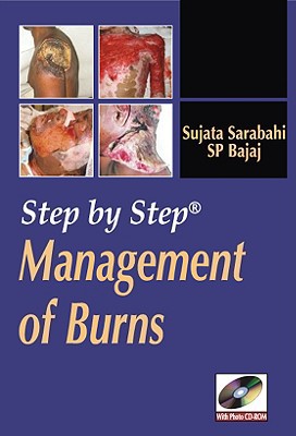 Book Step By Step Management Of Burns free