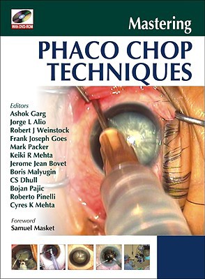Book Mastering Phaco Chop Techniques free