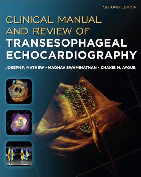 Book Clinical Manual and Review of Transesophageal Echocardiography, Second Edition free