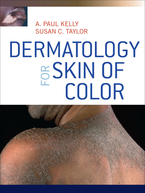 Book Dermatology for Skin of Color free