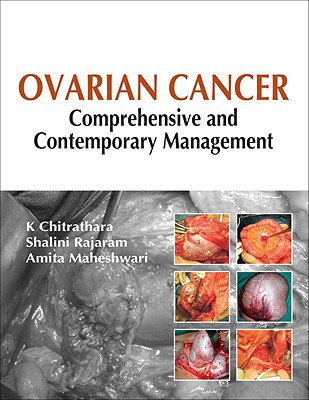 Book Ovarian Cancer: Comprehensive and Contemporary Management free