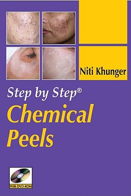 Book Step By Step Chemical Peels free