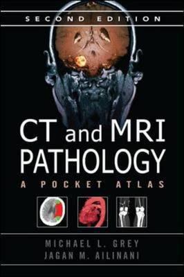Book CT & MRI Pathology: A Pocket Atlas, Second Edition free